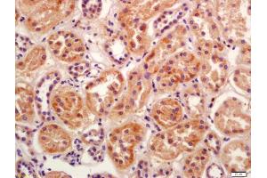 Formalin-fixed and paraffin embedded human kidney labeled with Anti-BBS5 Polyclonal Antibody, Unconjugated (ABIN1386114) at 1:200 followed by conjugation to the secondary antibody and DAB staining (BBS5 antibody  (AA 220-270))