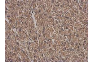 IHC-P Image Immunohistochemical analysis of paraffin-embedded U87 xenograft, using HSF2BP, antibody at 1:500 dilution. (HSF2BP antibody)