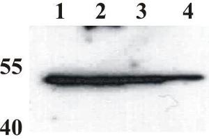 Western Blot testing of anti-BPV E2 monoclonal antibody (1E2). (Bovine Papilloma Virus 1 E2 (BPV-1 E2) (AA 208-218) antibody)