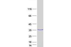 Western Blotting (WB) image for Hydroxysteroid (17-Beta) Dehydrogenase 3 (HSD17B3) protein (Myc-DYKDDDDK Tag) (ABIN2714229)