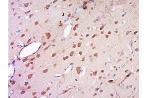 Paraformaldehyde-fixed, paraffin embedded rat brain, Antigen retrieval by boiling in sodium citrate buffer (pH6) for 15min, Block endogenous peroxidase by 3% hydrogen peroxide for 30 minutes, Blocking buffer (normal goat serum) at 37°C for 20min, Antibody incubation with Rabbit Anti-AMN1 Polyclonal Antibody, Unconjugated  at 1:500 overnight at 4°C, followed by a conjugated secondary for 90 minutes and DAB staining. (AMN1 antibody  (AA 1-100))