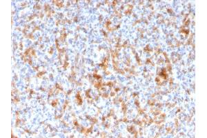 Immunohistochemistry (IHC) image for anti-Granzyme B (GZMB) (AA 73-187) antibody (ABIN6939593)