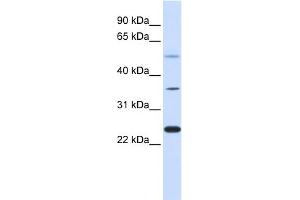 WB Suggested Anti-ZNF488 Antibody Titration:  0. (ZNF488 antibody  (Middle Region))