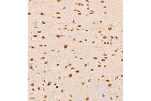 Immunohistochemistry of paraffin embedded mouse brain using ALS2CR13 (ABIN7073909) at dilution of 1:1800 (400x lens) (FAM117B antibody)