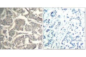 Image no. 3 for anti-Cofilin 1 (CFL1) (Tyr88) antibody (ABIN319381) (Cofilin antibody  (Tyr88))