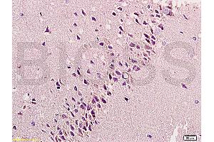 Immunohistochemistry (IHC) image for anti-Fibroblast Growth Factor 2 (Basic) (FGF2) (AA 143-250) antibody (ABIN726425)