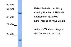 Western Blotting (WB) image for anti-Myotubularin 1 (MTM1) (N-Term) antibody (ABIN971203) (MTM1 antibody  (N-Term))