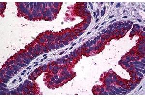 Human Prostate: Formalin-Fixed, Paraffin-Embedded (FFPE) (MAPK13 antibody  (AA 251-365))