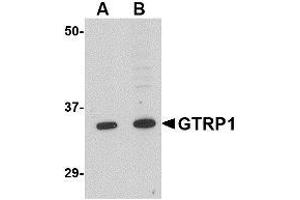Western blot analysis of GRTP1 in K562 cell lysate with AP30387PU-N GRTP1 antibody at (A) 1 and (B) 2 μg/ml.