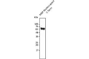 Western Blotting (WB) image for anti-SARS-CoV-2 Nucleocapsid (SARS-CoV-2 N) (C-Term) antibody (ABIN7272991) (SARS-CoV-2 Nucleocapsid antibody  (C-Term))