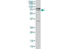 ZNF181 monoclonal antibody (M01), clone 5F1 Western Blot analysis of ZNF181 expression in A-431 . (ZNF181 antibody  (AA 354-461))