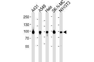 Western blot analysis of lysates from A431, A549, Hela, SK-N-MC, mouse NIH/3T3 cell line (from left to right), using HSP90 Antibody (Center) (ABIN6243458 and ABIN6577427). (HSP90 antibody  (AA 299-331))