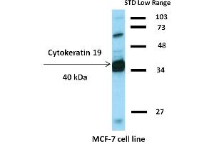 Western blotting analysis of human cytokeratin 19 using mouse monoclonal antibody BA-17 on lysates of HT-29 cell line and MOLT-4 cell line (cytokeratin non-expressing cell line, negative control) under non-reducing and reducing conditions. (Cytokeratin 19 antibody  (Biotin))