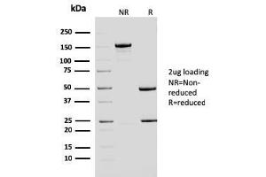 SDS-PAGE Analysis Purified ERCC1 Mouse Monoclonal Antibody (ERCC1/2683).