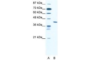 ZNF621 antibody (20R-1078) used at 0. (ZNF621 antibody  (Middle Region))