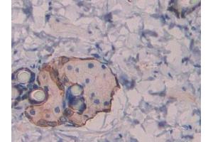 DAB staining on IHC-P; Samples: Rat Skin Tissue (Reelin antibody  (AA 2400-2610))
