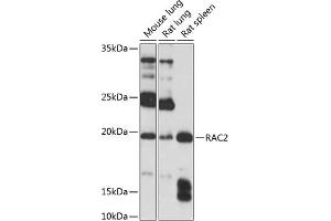 Western blot analysis of extracts of various cell lines, using R Polyclonal Antibody (ABIN3021523, ABIN3021524, ABIN3021525 and ABIN6215193) at 1:1000 dilution. (RAC2 antibody  (AA 1-192))