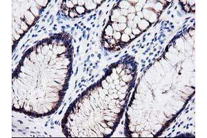 Immunohistochemical staining of paraffin-embedded Human colon tissue using anti-LXN mouse monoclonal antibody. (Latexin antibody)