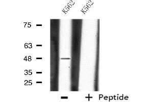 Western blot analysis of extracts from K562 cells, using CHST1 antibody. (CHST1 antibody  (Internal Region))
