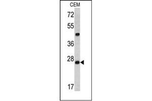 Image no. 1 for anti-Dicer 1, Ribonuclease Type III (DICER1) (AA 1010-1040), (Middle Region) antibody (ABIN357311) (DICER1 antibody  (Middle Region))