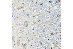 Immunohistochemistry (Paraffin-embedded Sections) (IHC (p)) image for anti-Aspartyl-tRNA Synthetase (DARS) (AA 222-501) antibody (ABIN6139407)