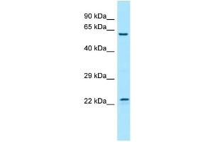 WB Suggested Anti-FGF17 Antibody Titration: 1. (FGF17 antibody  (Middle Region))