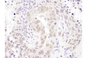 Immunohistochemistry (IHC) image for anti-Hexamethylene Bis-Acetamide Inducible 1 (HEXIM1) (AA 175-225) antibody (ABIN7454895)