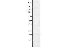 Western blot analysis of MED29 using HT29 whole cell lysates (MED29 antibody  (Internal Region))