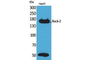 Western Blotting (WB) image for anti-rho-Associated, Coiled-Coil Containing Protein Kinase 2 (ROCK2) (Internal Region) antibody (ABIN3178224) (ROCK2 antibody  (Internal Region))