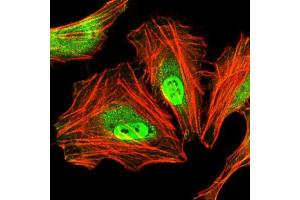 Immunocytochemistry (ICC) image for anti-CCAAT/enhancer Binding Protein (C/EBP), alpha (CEBPA) antibody (ABIN1845802) (CEBPA antibody)