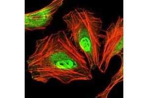 Immunocytochemistry (ICC) image for anti-CCAAT/enhancer Binding Protein (C/EBP), alpha (CEBPA) antibody (ABIN1845802) (CEBPA antibody)