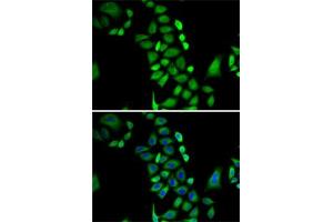 Immunofluorescence analysis of A-549 cells using GLO1 antibody (ABIN3015726, ABIN3015727, ABIN3015728 and ABIN6219077). (GLO1 antibody  (AA 1-184))