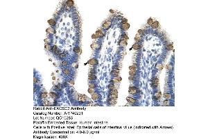 Rabbit Anti-EXOSC3 Antibody  Paraffin Embedded Tissue: Human Intestine Cellular Data: Epithelial cells of intestinal villas Antibody Concentration: 4. (EXOSC3 antibody  (Middle Region))
