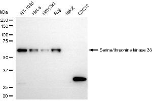 Western blotting analysis using serine/threonine kinase 33 antibody (ABIN7800313). (Recombinant STK33 antibody)