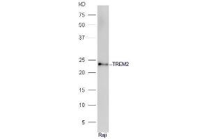 Raje cell lysates probed with Anti-TREM2 Polyclonal Antibody, Unconjugated  at 1:5000 90min in 37˚C.