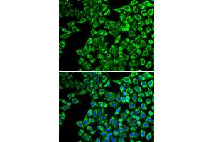 Immunofluorescence analysis of A549 cells using LIPC antibody. (LIPC antibody)