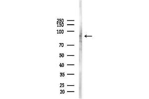 Western blot analysis of lysates from COLO205 cells(heat-shock,45 min treatment), using Ataxin 1 Antibody at 1/1000 dilution.