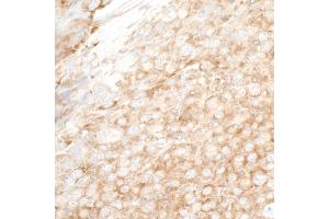 Immunohistochemistry (IHC) image for anti-Y Box Binding Protein 1 (YBX1) (AA 224-274) antibody (ABIN7453588)