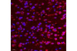 Immunofluorescence of paraffin embedded rat brain using AMIGO2 (ABIN7072966) at dilution of 1: 1300 (400x lens)