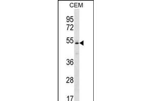 KCNJ4 Antibody (N-term) (ABIN656232 and ABIN2845547) western blot analysis in CEM cell line lysates (35 μg/lane). (KCNJ4 antibody  (N-Term))
