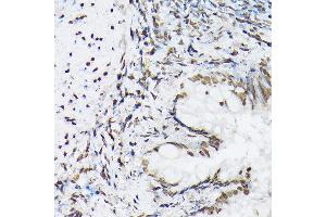 Immunohistochemistry of paraffin-embedded rat lung using Histone H1t Rabbit pAb (ABIN7267716) at dilution of 1:100 (40x lens). (Histone H1 antibody  (AA 150-207))