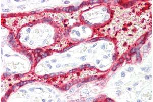 ABIN185616 (3. (HSD3B1 antibody  (C-Term))