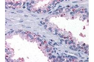 Immunohistochemical analysis of paraffin-embedded human prostate tissue using BDH1 monoclonal antibody, clone 1A5 .