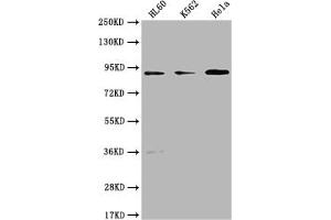 Western Blot Positive WB detected in: HL60 whole cell lysate, K562 whole cell lysate, Hela whole cell lysate All lanes: RPTN antibody at 1:1000 Secondary Goat polyclonal to rabbit IgG at 1/50000 dilution Predicted band size: 91 kDa Observed band size: 91 kDa (Repetin antibody  (AA 86-103))