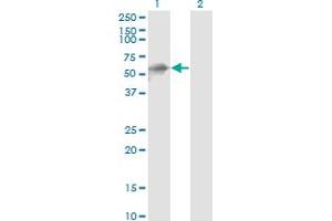 Western Blot analysis of KBTBD10 expression in transfected 293T cell line by KBTBD10 monoclonal antibody (M01), clone 1H3.