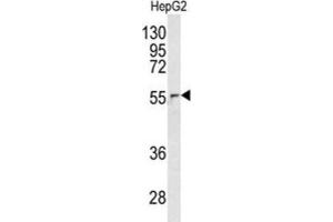 Western Blotting (WB) image for anti-Nucleoporin 62kDa (NUP62) antibody (ABIN3003247)