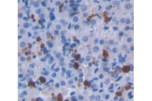 Figure. (ALAD antibody  (AA 1-330))