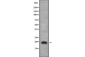 Western blot analysis of JDP2 using COLO205 whole cell lysates