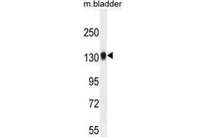 TDRD7 Antibody (C-term) western blot analysis in mouse bladder tissue lysates (35 µg/lane). (TDRD7 antibody  (C-Term))