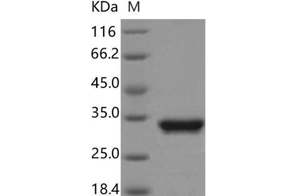 GFP Protein (His tag)